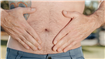 Hernia inghinală la adulți: diagnostic, evoluție şi când devine o urgenţă medicală?